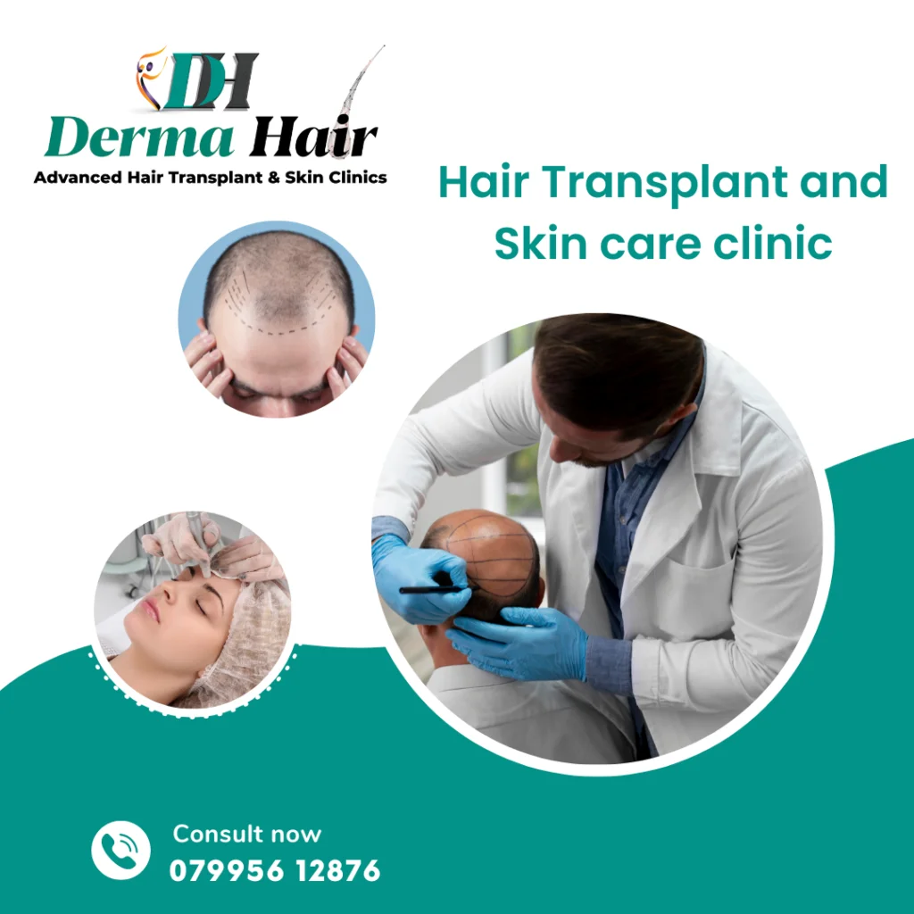 Derma Hair advanced hair transplant and skin care clinic — surgeon marking a patient's scalp