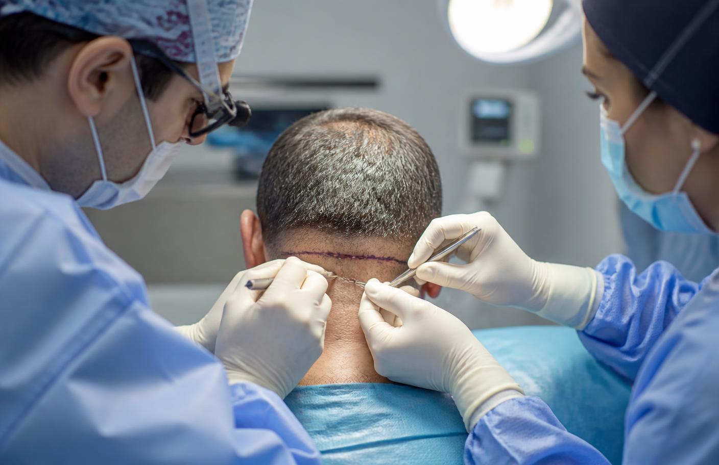 Surgeon performing FUT strip harvesting on a male patient's donor area